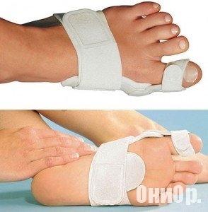 Valufix внешний вид