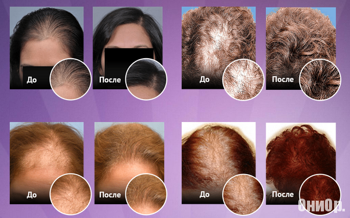 Shevelux результаты применения