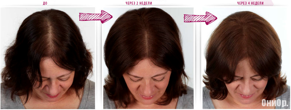 Ultra Hair Spray эффект от использования