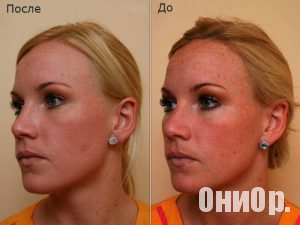 Welltox результат