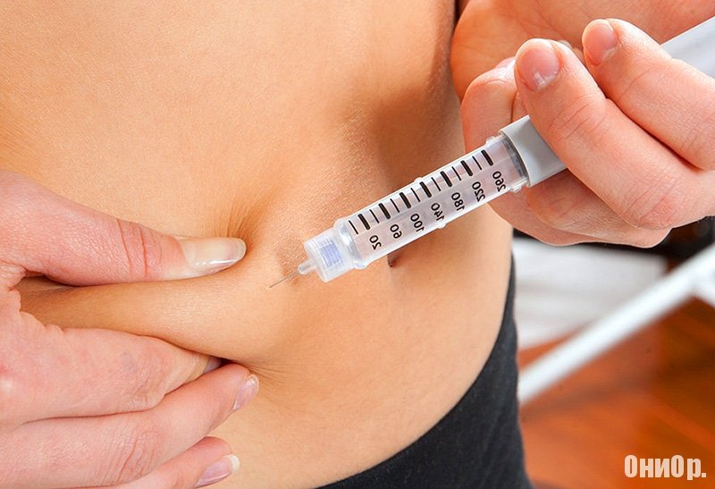 Инъекция инсулина