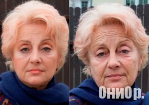 Lucerin результат