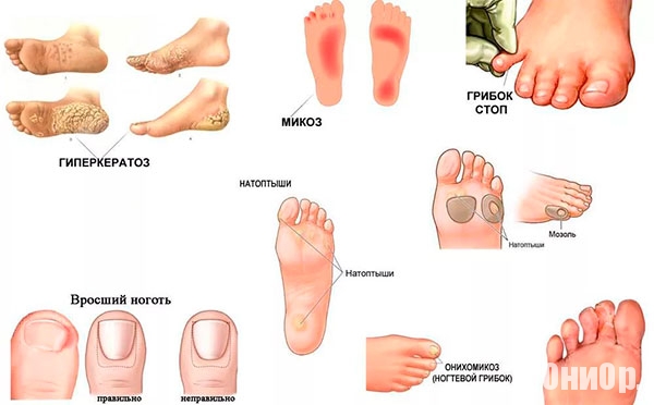 Nomidol показание